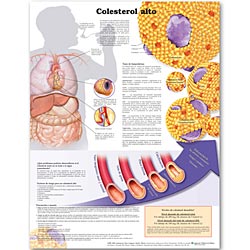 High Cholesterol Spanish Paper