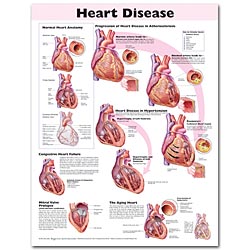 Heart Disease 2E 20x26 Laminated