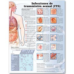 Sexually Trans. Infections Spanish 20x26 Paper