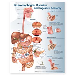 GASTROESOPHAGEAL DISORDERS (G.E.R.D.) DIGES ANATOMY LAMINATED, 2nd Edition