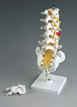 LUMBAR VERTEBRAL COL. W/HERN DISC-FLEX