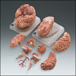 BRAIN WITH ARTERIES MODEL