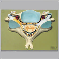 FIFTH CERVICAL VERTEBRA