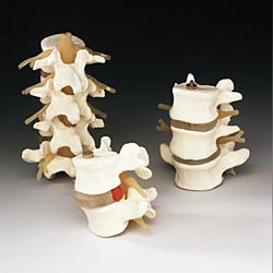 4 PIECE LUMBAR SET