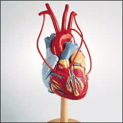 HEART OF AMERICA MODEL W/BYPASS