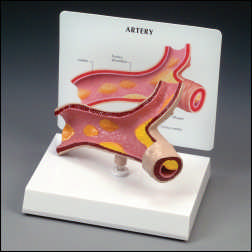 ARTERY SECTION MODEL WITH KEY CARD