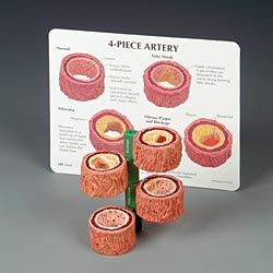 4-pc Artery Model  New 2008