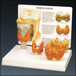 THYROID DISORDERS MODEL