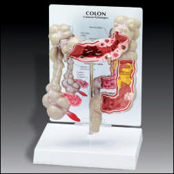 COLON WITH KEY CARD