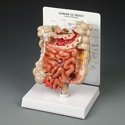 LOWER GI TRACT MODEL  NEW 2009