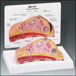 BREAST CROSS SECTION MODEL W/CARD