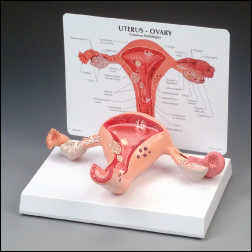 UTERUS-OVARY MODEL