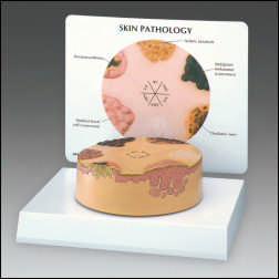 SKIN PATHOLOGIES (CANCER) WITH KEY CARD