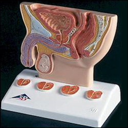 PROSTATE MODEL W/CROSS SECTION 5"X5"X4""