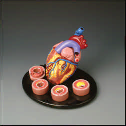 Heart Conditions Model