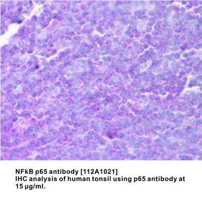 NFkB p65 antibody [112A1021], GeneTex