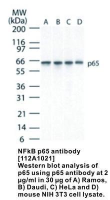 NFkB p65 antibody [112A1021], GeneTex