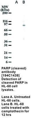 PARP (cleaved) antibody [194C1439], GeneTex