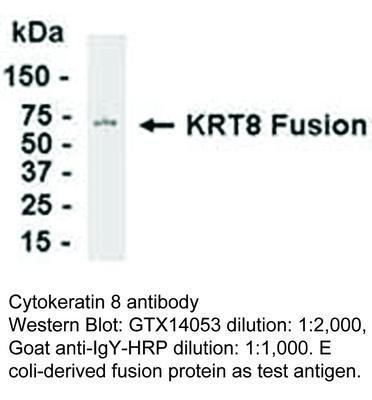 Cytokeratin 8 antibody, GeneTex