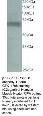 p70S6K / RPS6KB1 antibody, C-term, GeneTex