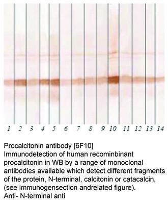 Procalcitonin antibody [6F10], GeneTex