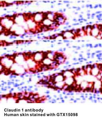 Claudin 3 antibody, GeneTex