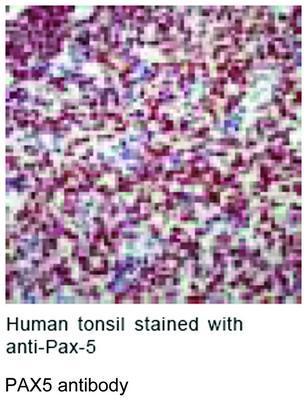 PAX5 antibody, GeneTex