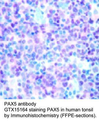 PAX5 antibody, GeneTex