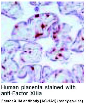 Factor XIIIA antibody [AC-1A1] (ready-to-use), GeneTex