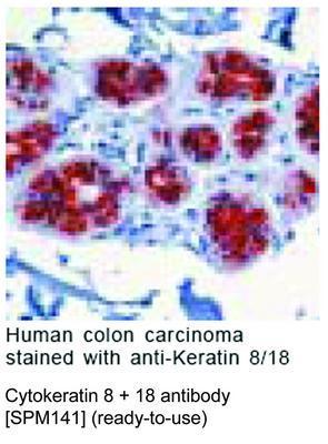 Cytokeratin 8 + 18 antibody [SPM141] (ready-to-use), GeneTex