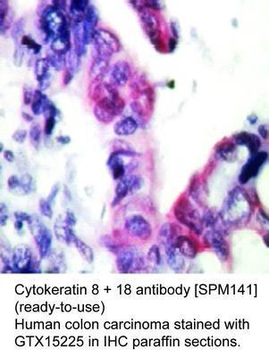 Cytokeratin 8 + 18 antibody [SPM141] (ready-to-use), GeneTex