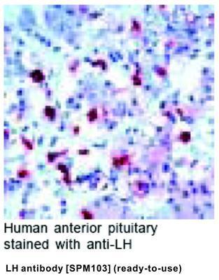 LH antibody [SPM103] (ready-to-use), GeneTex