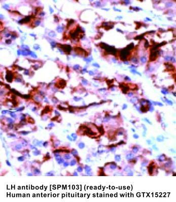 LH antibody [SPM103] (ready-to-use), GeneTex