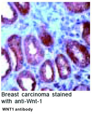 WNT1 antibody - 500µl, GeneTex