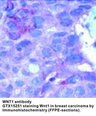 WNT1 antibody - 500µl, GeneTex