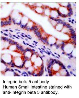 Integrin beta 5 antibody, GeneTex