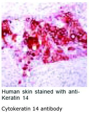 Cytokeratin 14 antibody, GeneTex