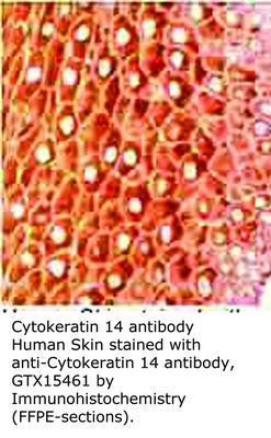 Cytokeratin 14 antibody, GeneTex