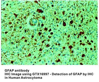 GFAP antibody - 1ml, GeneTex