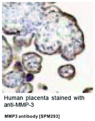 MMP3 antibody [SPM293], GeneTex