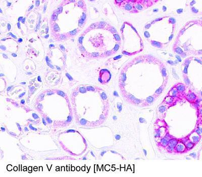 Collagen V antibody [MC5-HA], GeneTex