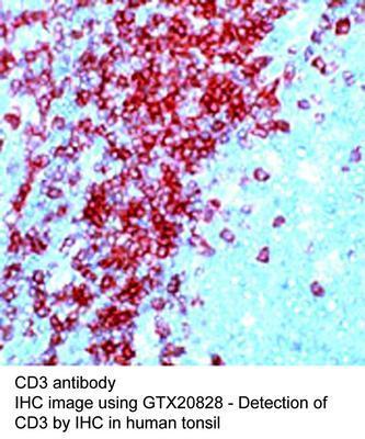 CD3 antibody - 500µl, GeneTex