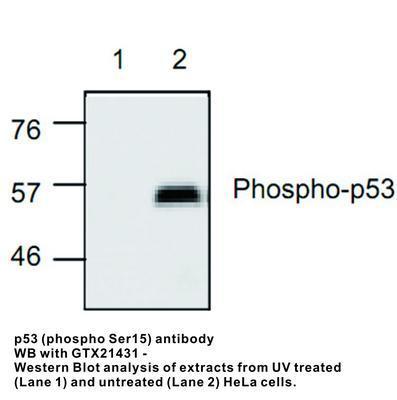 p53 (phospho Ser15) antibody, GeneTex