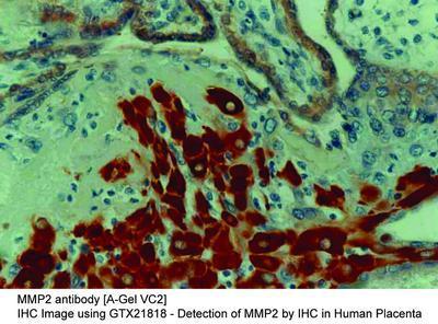 MMP2 antibody [A-Gel VC2], GeneTex