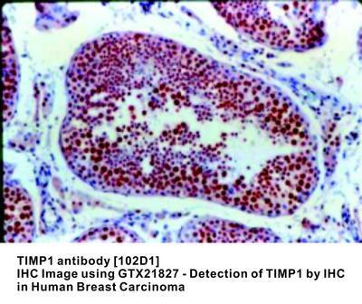 TIMP1 antibody [102D1], GeneTex