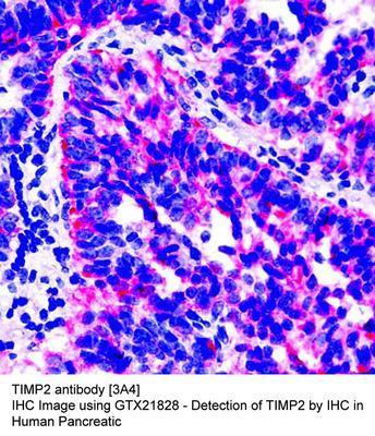 TIMP2 antibody [3A4], GeneTex