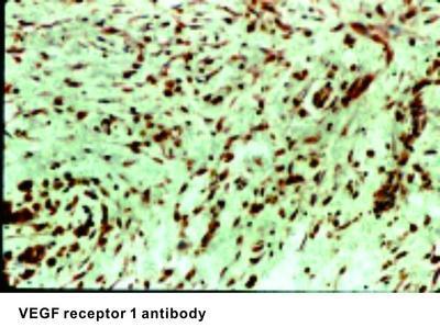 VEGF receptor 1 antibody, GeneTex