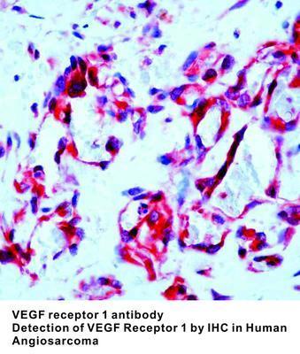 VEGF receptor 1 antibody, GeneTex