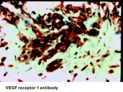 VEGF receptor 1 antibody, GeneTex