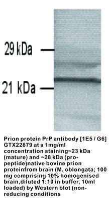 Prion protein PrP antibody [1E5 / G6], GeneTex